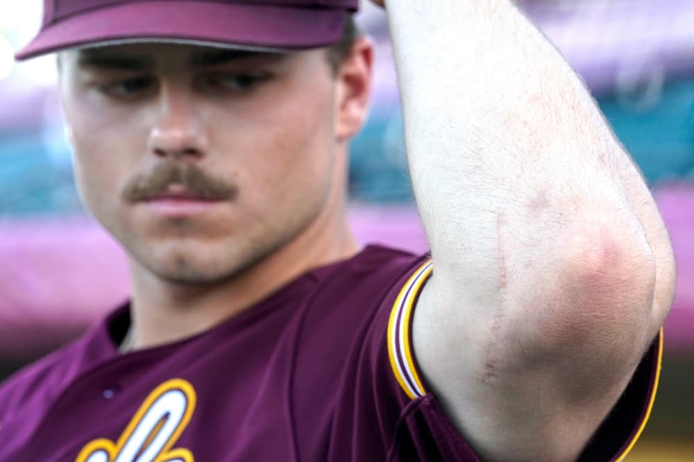 Hard-throwing teens draw scouts, scholarships. More and more, they may also need Tommy John surgery